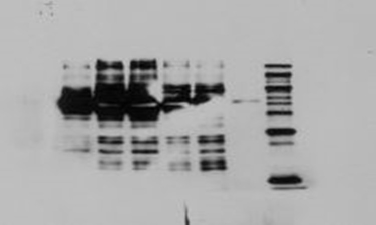 Western Blot Ҋ(jin)(wn)}